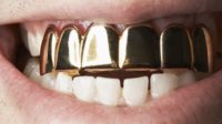 Hukum Melepas Gigi Emas Pada Jenazah